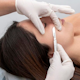 Dermaplane Facial